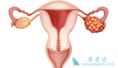 �ѳ��������ܻ��ú��ѳ�������֢״����