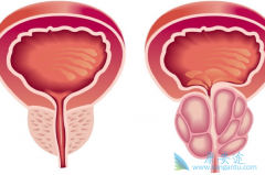 ����ǰ���ٰ�֢�ð����������ƺ���