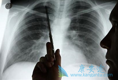 奥希替尼 奥希替尼