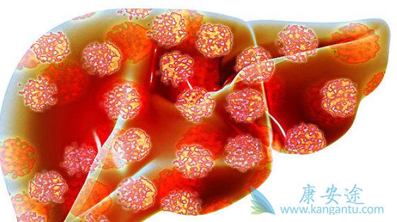 乙肝病毒 乙肝病毒