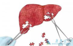 �Ҹβ���Я���߻ᴫȾ����Ӳ����