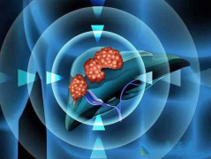 �Ҹκ��Ŀ������Ի��Ҹα��濹��������ʲô��˼��