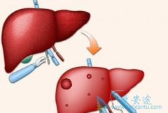 ���������Ҫ�����β��������𣿱��ο���������ʲô��˼��