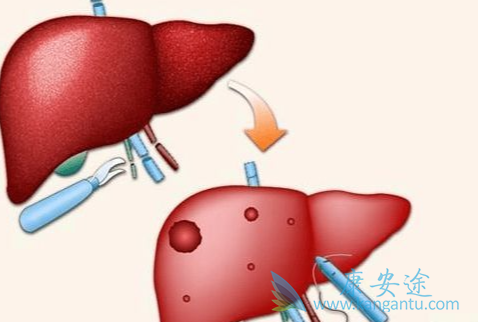 丙肝病毒抗体;丙肝抗体阳性 丙肝病毒抗体;丙肝抗体阳性