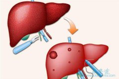 �Ҹβ����ĸ�Ⱦ�ʴ����Ҹα��濹��������ʲô��