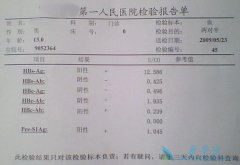 �Ҹα��濹����ʲô��˼���Ҹ�����ָ������Щ��