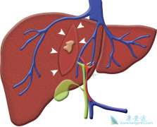 ���δ�Ⱦ�𣿱��ο���������Ҫ������