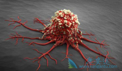 ��ɳ��������������ǵڶ�����TKI