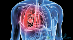 ���ַΰ�Ҫ����Ľ��зΰ�������