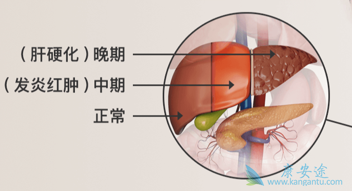 丙肝病毒 丙肝病毒