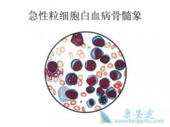 �������Ѫ��������ʲô����Ѫ������ʲô����ģ�