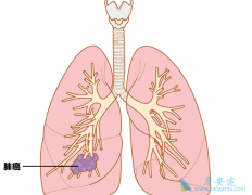 ��Сϸ���ΰ����������ڷΰ������Ʒ�����ʲô��