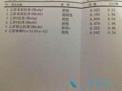 �Ҹα��濹�����Ե�������ʲô��Ϊʲô�����Ҹκ��Ŀ������ԣ�