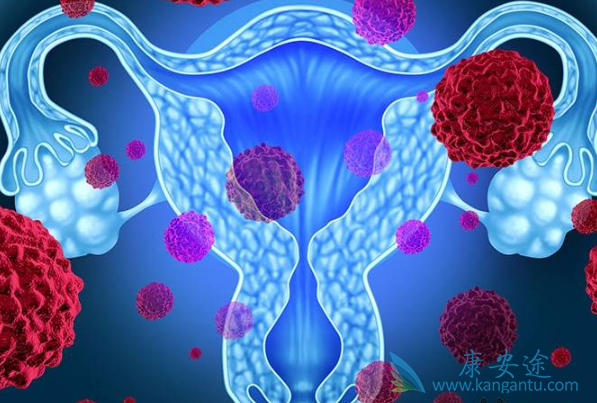 子宫癌的原因 子宫癌的原因