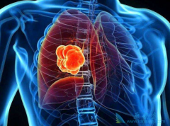 ����˻�ƺ����� ��ǻ��Һ���ֶ��Ƿΰ���֢״��