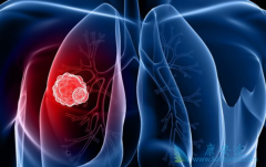 ���Ʒΰ��ֶε�����Щ�����ڷ�Сϸ���ΰ�Ӧ��ѡ�����ߵ����Ʒ�ʽ