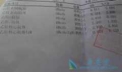 �Ҹα��濹����ʲô��˼�����͸���������