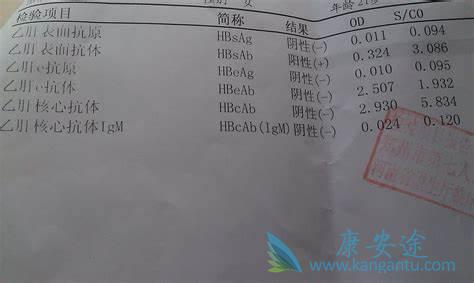 乙肝表面抗体 乙肝表面抗体