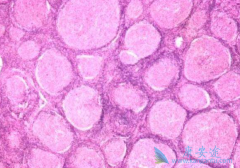 ������ܰ������ٴ����ֺͲ���Ԥ������