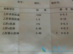 �Ҹβ�����Ⱦ�Ը����Ҹα��濹��������ʲô��˼��