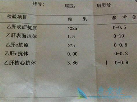 乙肝表面抗体 乙肝表面抗体