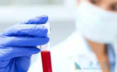 �Ҹ����԰뻯�鵥��ô�����Ƿ���Ҫ�����Ҹ����磿