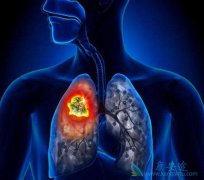 �ΰ�����ϸ����ɢ�Ļ���Ҫ������������ 