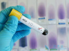 ���ο��忹ԭ���ϼ����ʲô���壿