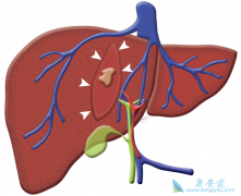 �����������𣿱�����ҩ���κñ�����