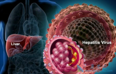 �Ҹκ��Ŀ������Ա��濹�������ǵ����Ҹ���