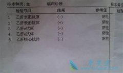 �Ҹβ����ĸ�Ⱦ�Դ����Ҹα��濹�����ļ��