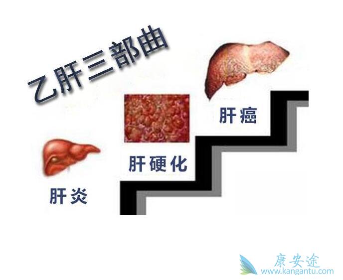 乙肝抗病毒治疗 乙肝抗病毒治疗