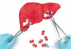 ��Ⱦ������ô�죿������������