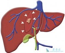 �����������𣿱������Ƶĺ���