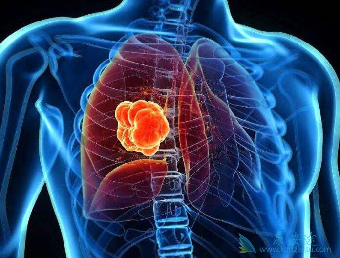 分子靶向治疗 分子靶向治疗