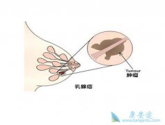 ת�������ٰ�������21��������� �������ٰ�ֻ���õ�ҩ������