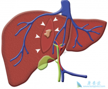 ���εĴ�Ⱦ�����𣿱��εĴ���;������