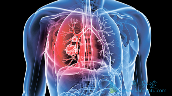 肺癌治疗;肺癌化疗 肺癌治疗;肺癌化疗