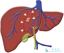 Ϊʲôȷ�ϱ��β�����Ҫ��鿹-HCV���������Ƶĺ���