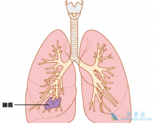 �ΰ�������Ч���������ٰ���Ů�Գ�����һ�ּ���