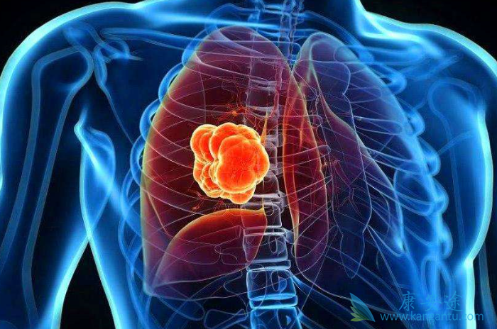 劳拉替尼 劳拉替尼