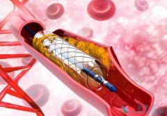 ʲô������֧�� �����ļ������ȴ���ļ�����Ҫ������֧�ܵ�����