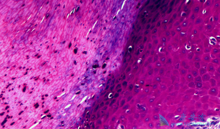 ��ɫ����;����