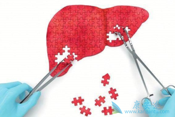 丙肝感染;治疗丙肝 丙肝感染;治疗丙肝