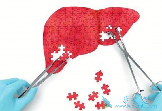 丙肝的治疗 丙肝的治疗