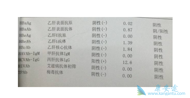丙肝抗体阳性 丙肝抗体阳性