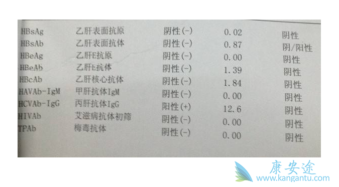丙肝抗体阳性 丙肝抗体阳性