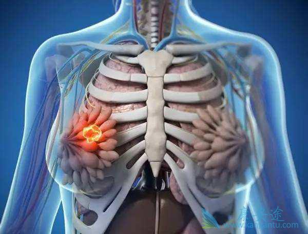 乳腺癌的晚期症状有哪些呢?