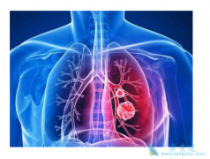 ת���Էΰ���֢״����Щ