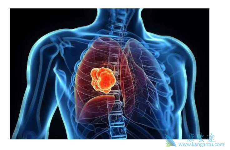 特罗凯耐药吗? 特罗凯耐药吗?